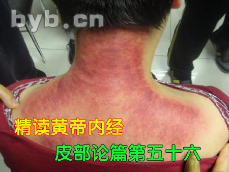 byb.cn 黃帝內(nèi)經(jīng)皮部論篇第五十六