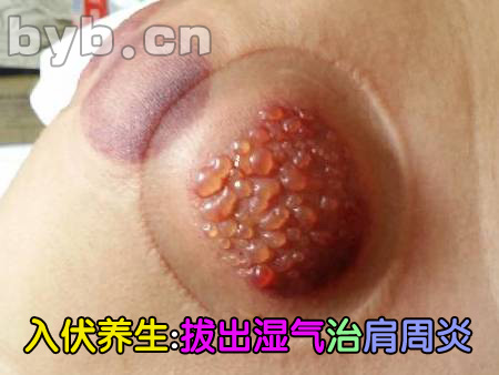 byb.cn byb.cn