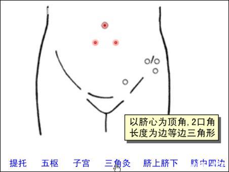 點(diǎn)擊查看三角灸的大圖